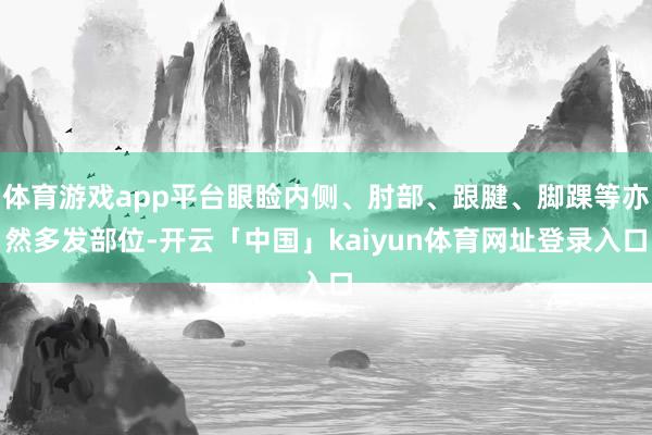 体育游戏app平台眼睑内侧、肘部、跟腱、脚踝等亦然多发部位-开云「中国」kaiyun体育网址登录入口